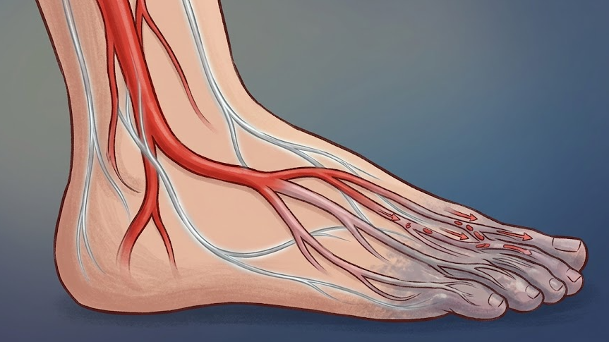 손발 저림 말초신경